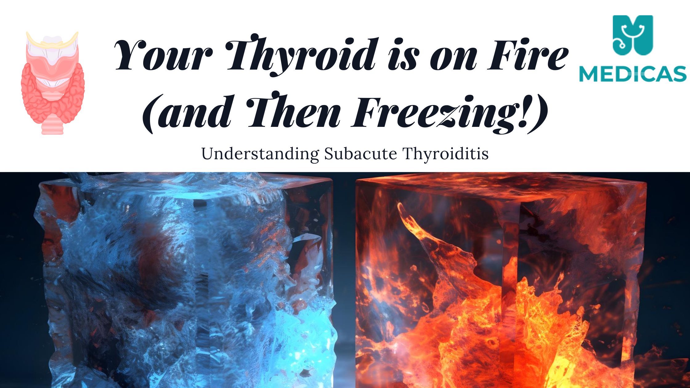 Understanding Subacute Thyroiditis: Symptoms, Causes, and Treatment