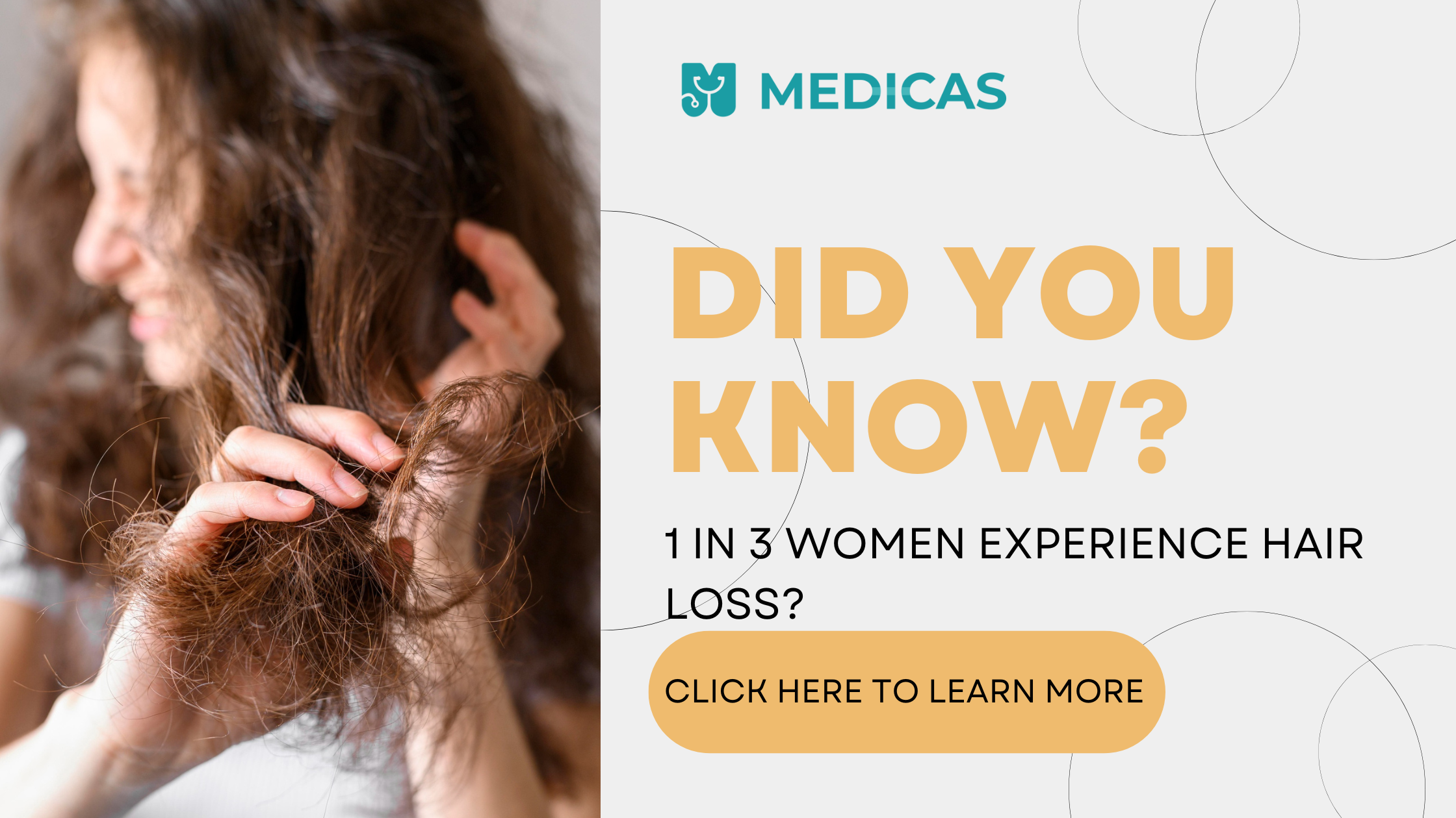 Hair loss in women – Symptoms, Causes and Prevention