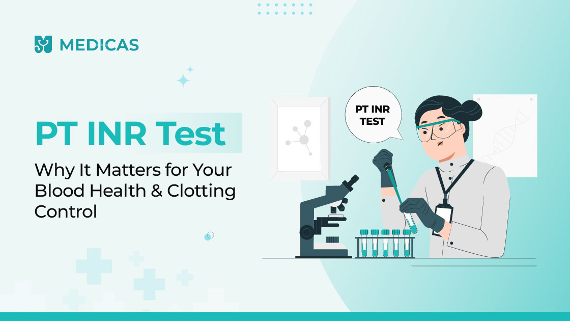 PT INR TEST NORMAL RANGE